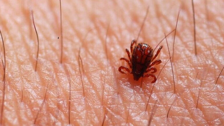 FEBRE MACULOSA