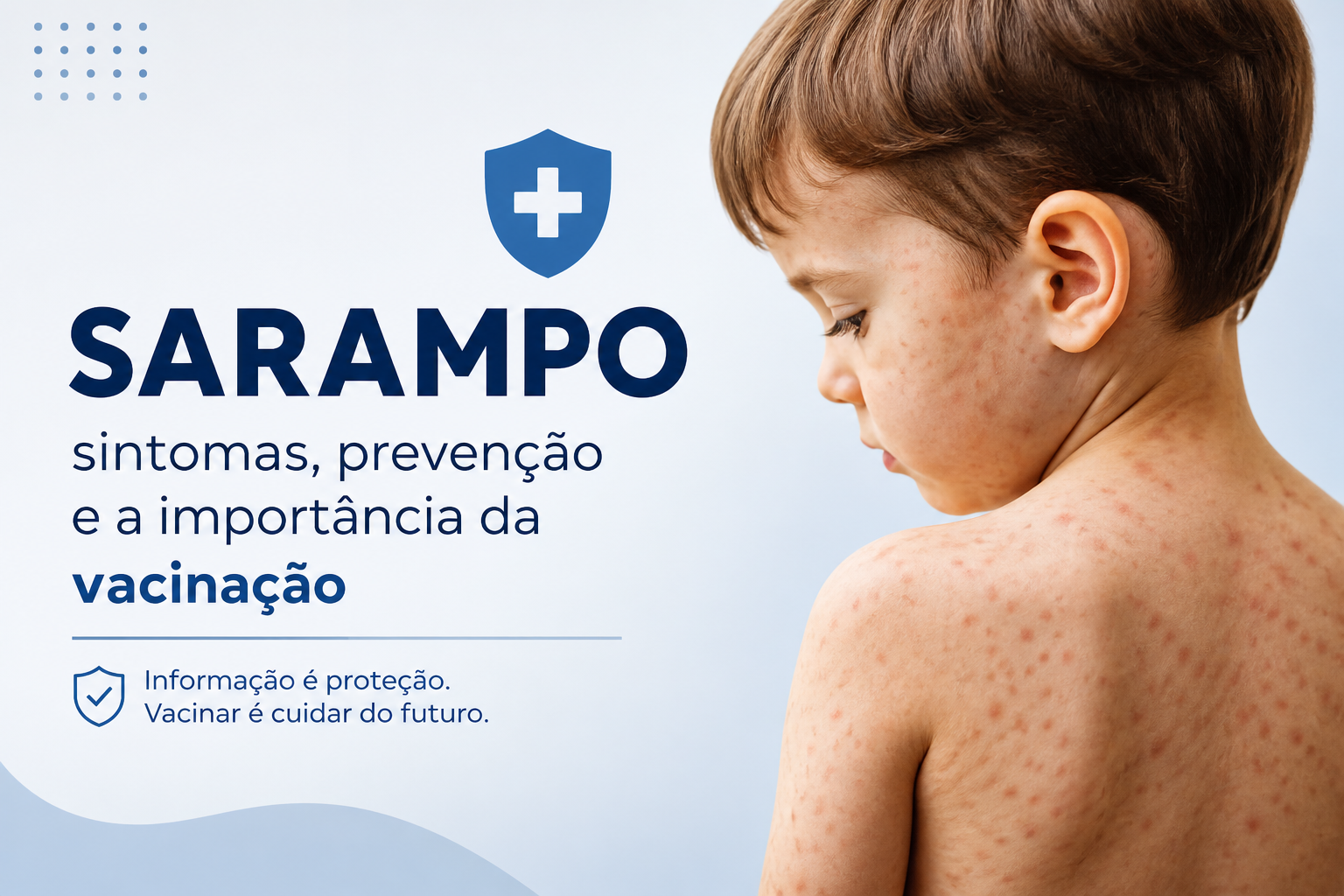 Sarampo